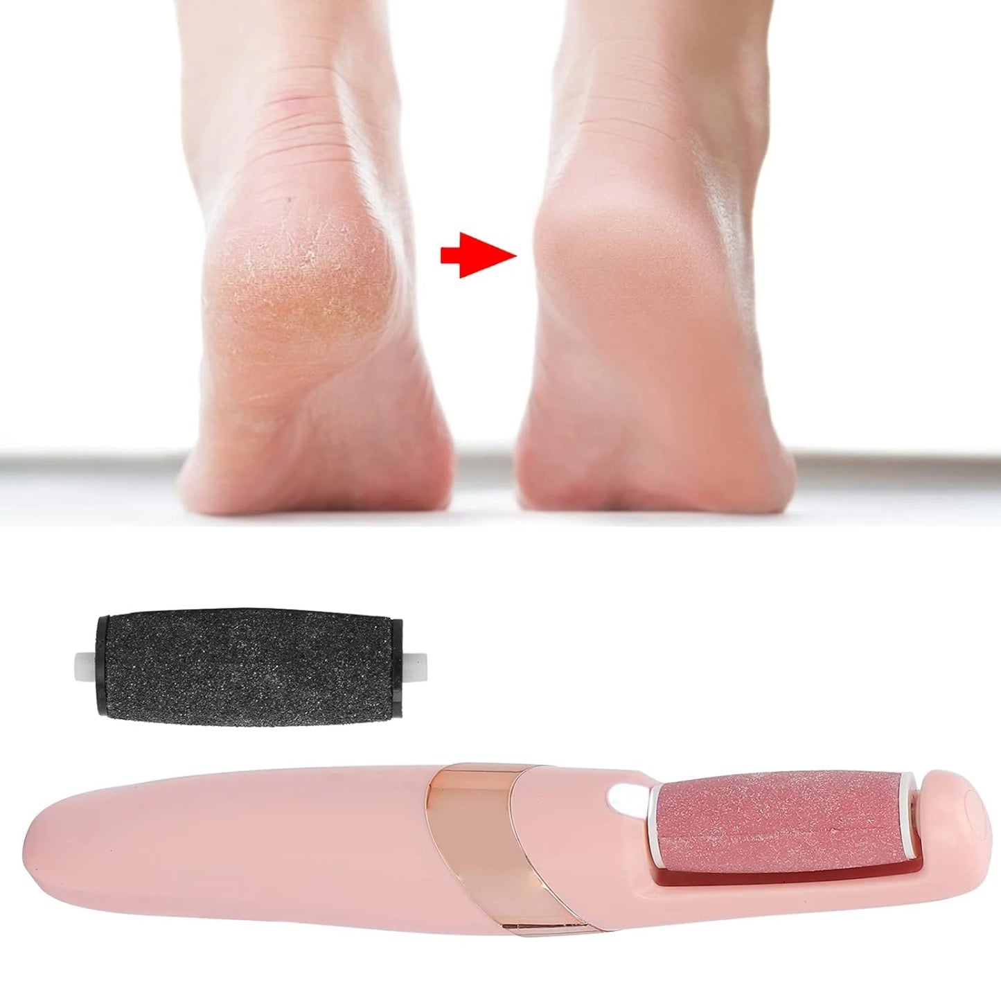 Callus Remover, Portable Electric Pedicure Tool for Soft Feet